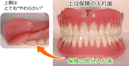 入れ歯・義歯 / 垂水区南多聞台・神陵台、明石市松が丘の歯医者
